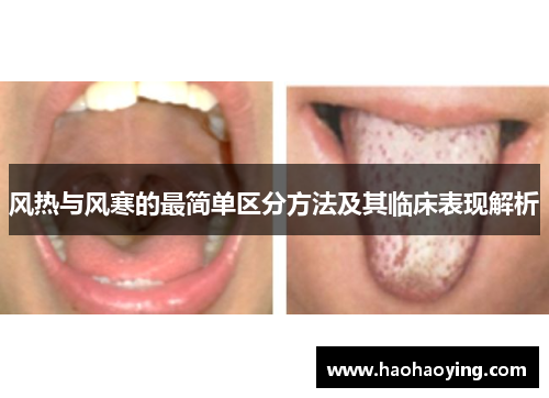风热与风寒的最简单区分方法及其临床表现解析